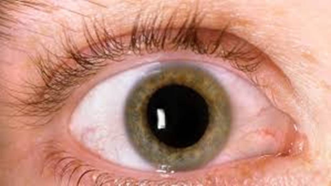 Diabetes to rheumatoid arthritis and ...